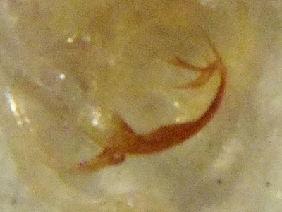 Edwardsiana tersa aedeagus